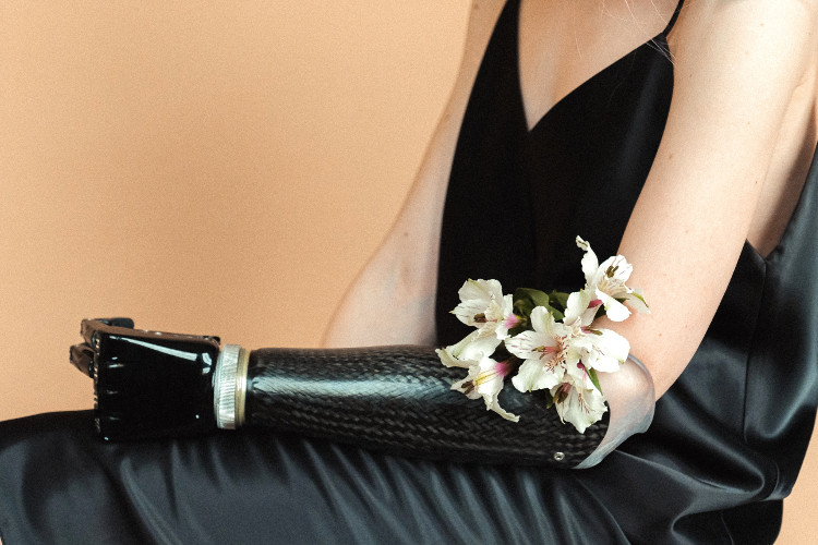 Creative photography. A girl in a black dress with a prosthetic arm and flowers.